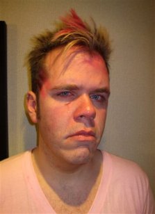 Canada Perez Hilton Punched